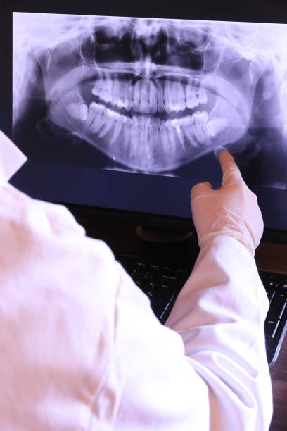 Best Emergency Tooth Extraction in Ellsworth, ME