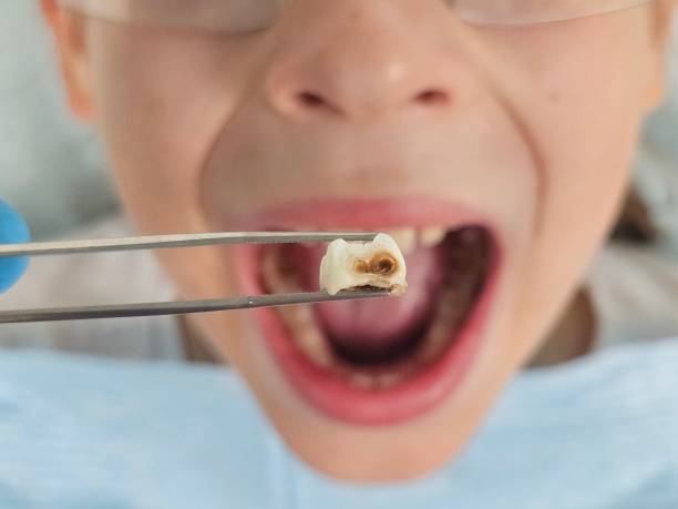 Best Emergency Gum Treatment in Ellsworth, ME